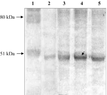 Fig. 1.  Western blot analysis of VP2 protein. Lane 1, standard protein marker; lane 2, BL21-SI host cells only and lane 3, cell lysate sample of 3 h induced recombinant plasmid