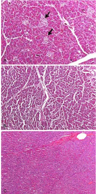 Fig. 3.  A. Normal pancreas. There are many islets (arrows). B.