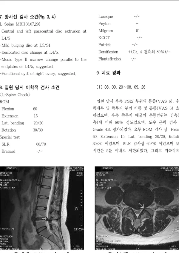 Fig. 3. Sagittal image of case 2 Fig. 4. L4/5 axial image of case 2