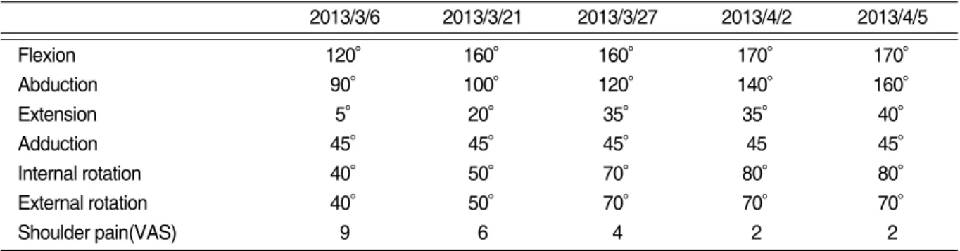 Table Ⅱ. The Improvement of Shoulder ROM and Pain 2013/3/6 2013/3/21 2013/3/27 2013/4/2 2013/4/5 Flexion 120° 160° 160° 170° 170° Abduction 90° 100° 120° 140° 160° Extension 5° 20° 35° 35° 40° Adduction 45° 45° 45° 45 45° Internal rotation 40° 50° 70° 80° 