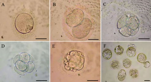 Fig. 2. Morphology of inner cell masses (ICMs) isolated from cloned blastocysts (A,  ×100) by immunosurgery and the phase contrast micrographs of a colony of SCNT-hES-1 cells (B,  ×100), and higher magnification (C, ×200)