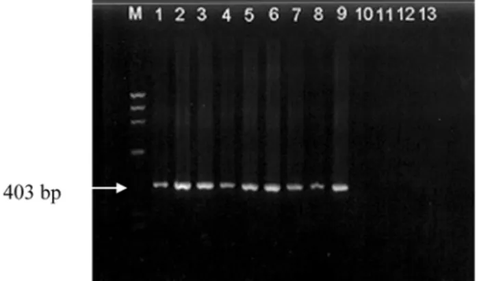Fig. 5.  Results of the multiplex PCR for detection of individual or combinations of bacterial agents from porcine intestinal feces.