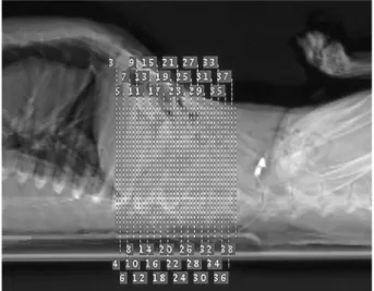 Fig. 1.  Lateral pilot CT image demonstrating patient positioning and locations of T11-L2 transverse slices.