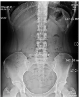 Fig. 3.  NRS ccore change of case 1.