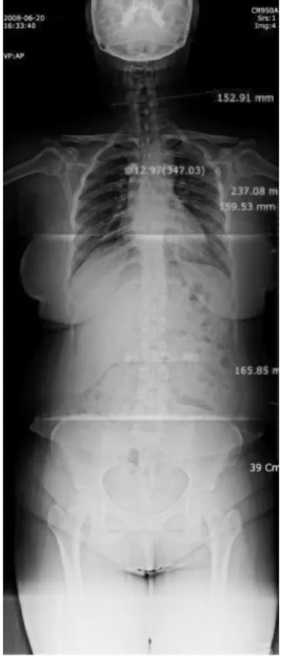 Fig. 4.  Case 1. before treatment. Fig. 5.  Case 1. after treatment.