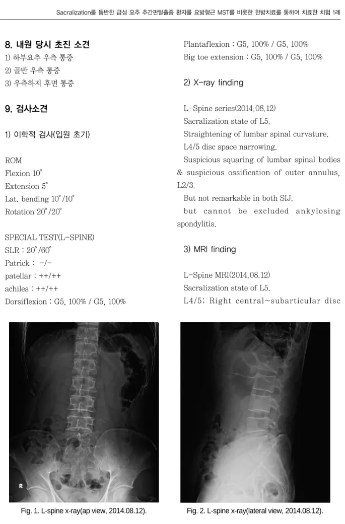 Fig. 1. L-spine x-ray(ap view, 2014.08.12). Fig. 2. L-spine x-ray(lateral view, 2014.08.12).
