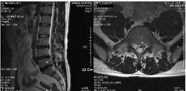 Fig. 7.  T2-weighted image of case 4 before treatment.