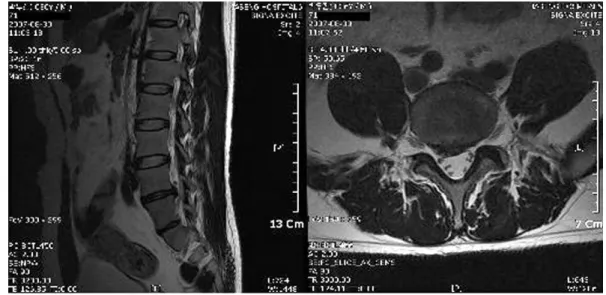 Fig. 3.  T2-weighted image of case 2 before treatment.