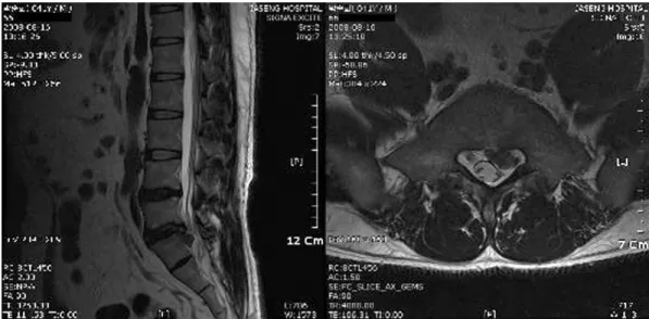 Fig. 5.  T2-weighted image of case 3 before treatment.