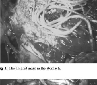 Fig. 1. The ascarid mass in the stomach.
