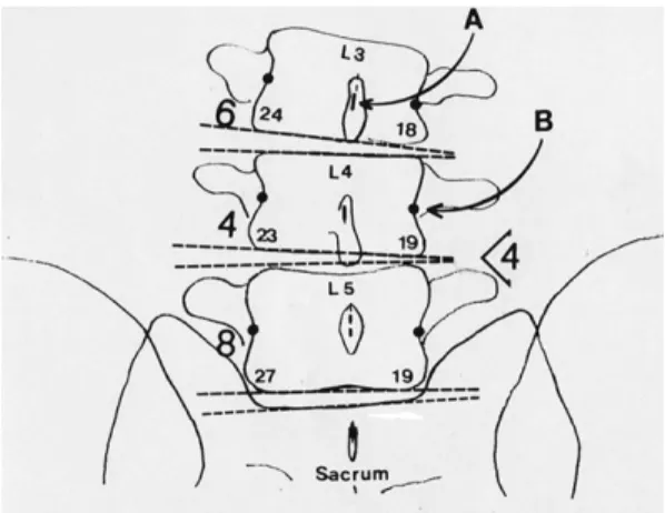 Fig. 2.  Acute lateral tortipelvis 3th lumbar.