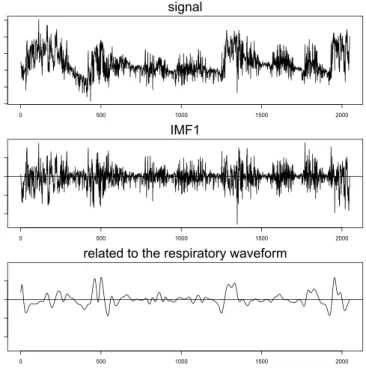 Figure 5.2. Reconstitution of the ECG data related to modified EMD