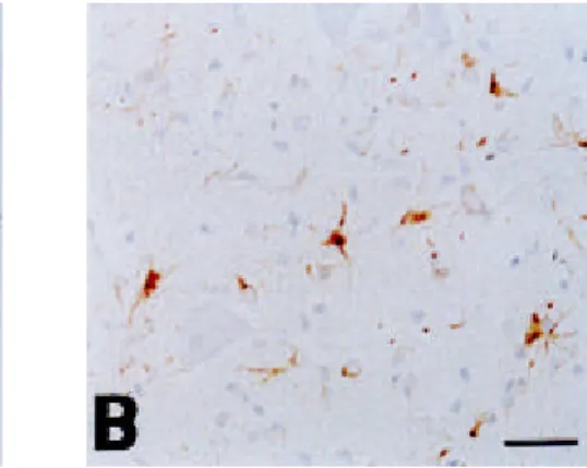 Fig . 2. Immunohistochemical staining of vimentin in the spinal cords of normal rats (A) and rats with EAE (B, C)