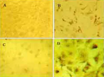 Fig. 3. Immunocytochemistry of BHK-21 cells expressing GP5.