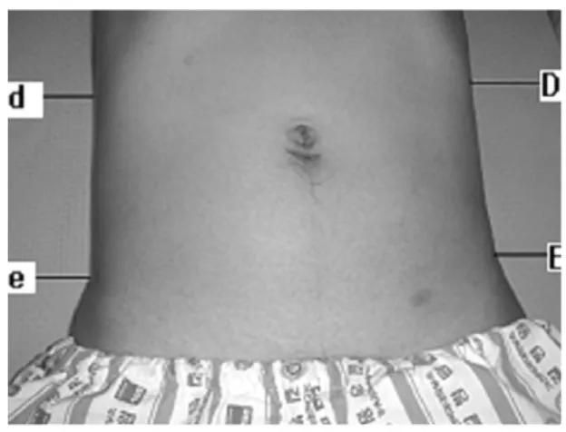 Fig. 9.  Posterior view  Fig. 10.  Abdomen view