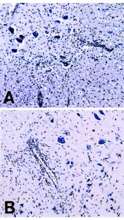 Fig. 3. Immunohistochemical detection of LFA-1a and ICAM-1 in melatonin-treated (B and D) and vehicle-treated (A and C) rats at the peak stage (day 14 PI) of EAE
