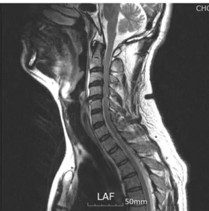 Fig. 1.  Cervical spine MRI(2009. 09. 07)
