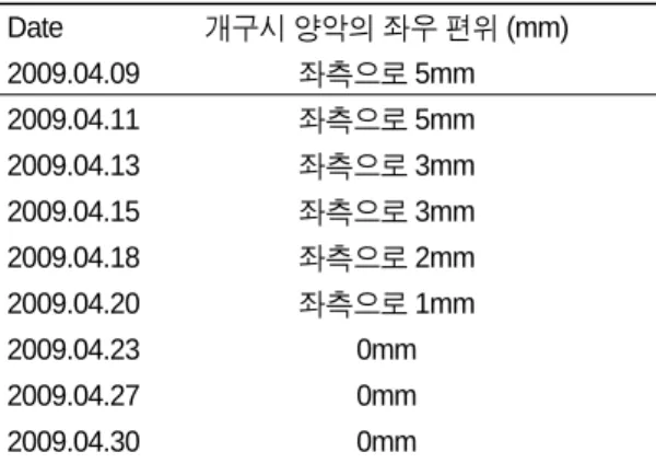 Fig. 15.  Deviation of Opening Mouth