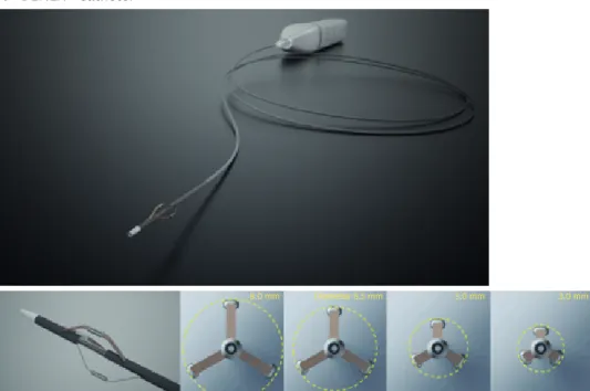 Figure 2. DENEX™ percutaneous RDN system. (A) DENEX™ catheter. (B) DENEX™ generator.