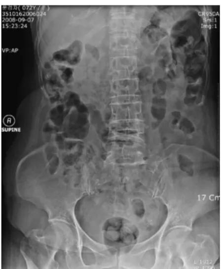 Fig. 3.  L-spine X-Ray AP image at 2008-09-07. Fig. 4.  L-spine X-Ray LAT image at  2008-09-07.