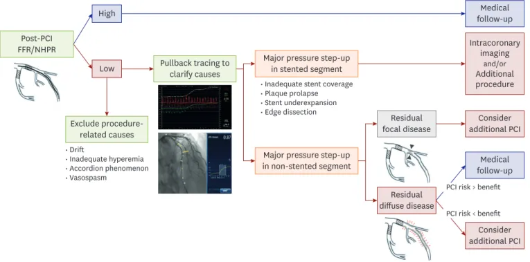 Figure 4. PCI optimization strategy with post-PCI physiologic assessment. 