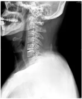 Fig. 1. C-spine lat. x-ray. (2010. 10. 18)