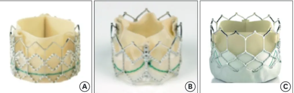 Figure 2. The evolution of Edwards Sapien Valve. (A) Edwards Sapien, (B) Edwards Sapien XT, and (C) Edwards  Sapien 3.