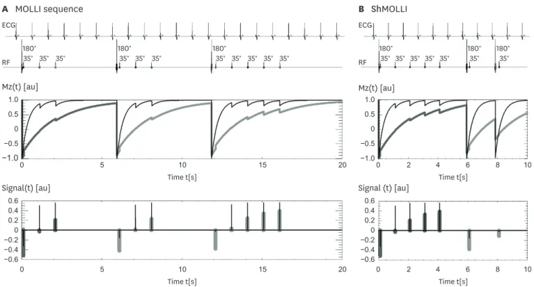 Figure 3. ECG-gated pulse sequence schemes for simulation of (A) MOLLI and (B) ShMOLLI at a heart rate of 60 bpm