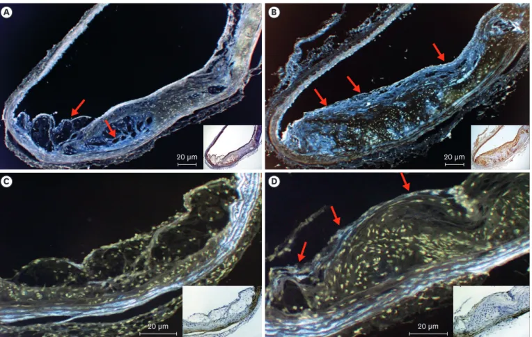 Figure 4. Immunochemistry and pseudo-color treatment of the aortic arch from mice in (A, C) the placebo and (B, D) dabigatran groups after 22 weeks of  experimental chow feeding