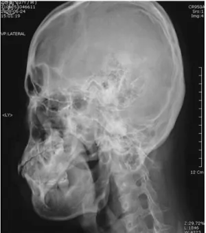 Fig. 3.  The change of NRS after treatment