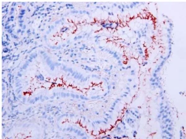 Table 2. Density score of H. pylori analyzed by H&amp;E, Giemsa,  Warthin-Starry and immunohistochemical stains in the gastric  mucosa