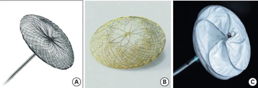 Figure 1. Devices used for atrial septal defect closure. (A) Amplatzer ®  septal occluder; (B) Occlutech Figulla ®  Flex  II; (C) Gore ®  septal occluder.