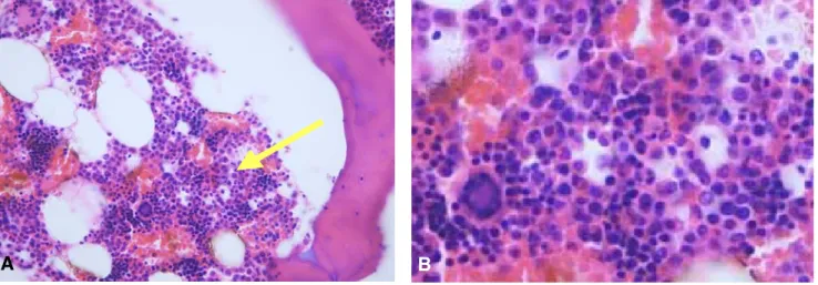 Fig. 3. Hematoxylin and eosin stainings in bone tissue to be decalcified by 10 % formic acid for 6 hours in 60 ℃ paraffin oven (H