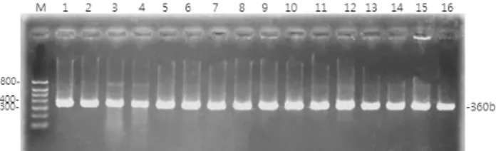Table  1.  Screening  numbers  of  NTM  and  MTB  by  multiplex  PCR  in  the  60  strains  of  pre-identified  NTM
