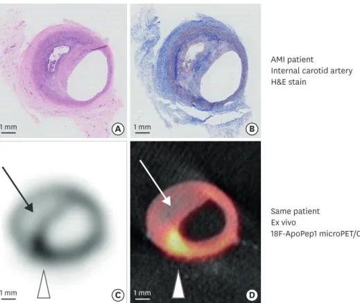 Figure 1. In vivo H&amp;E staining and ex vivo PET imaging of 18F-ApoPep1 to detect plaque apoptosis and vulnerability