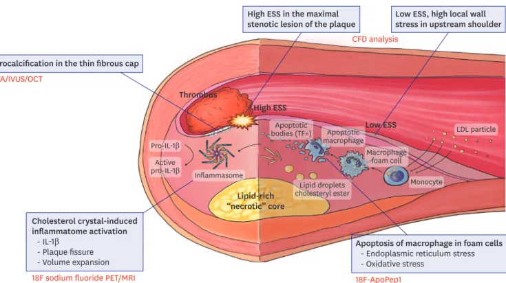 Figure 2. Newly added pathophysiological concept of vulnerable plaques and the applicable imaging modalities to detect the process of plaque rupture