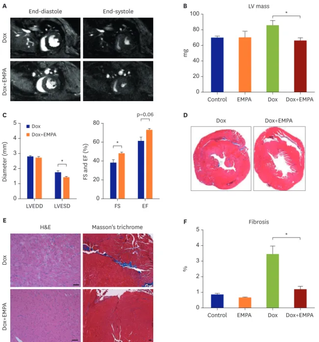 Figure 1. The SGLT2 inhibitor protects against Dox-induced cardiac toxicity. (A) Representative images of Dox-mediated changes in cardiac structure and function  from cardiac MRI