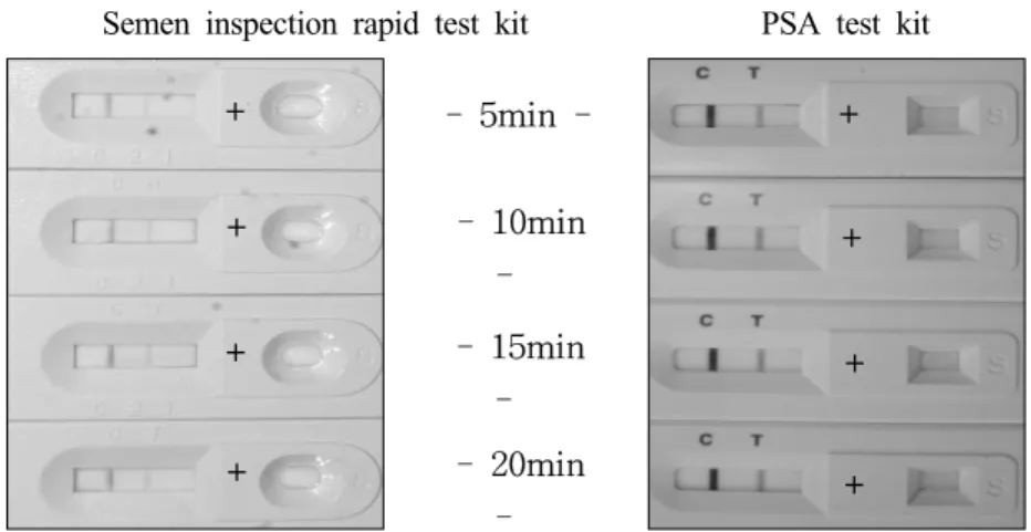 Fig. 2. Effect of boiling on the stability of PSA. 100-fold diluted semen solutions were boiled at 96℃ for 5, 10, 15, and 20 minutes