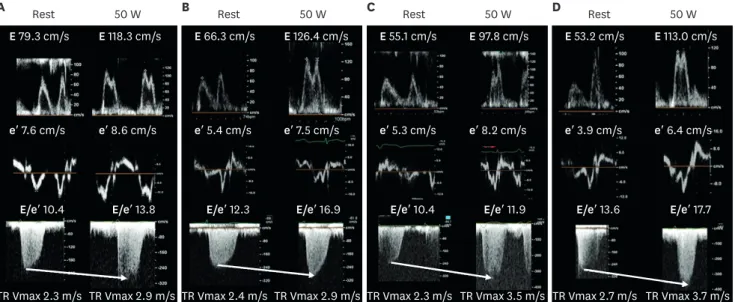 Table 3. Baseline clinical variables according to the patterns of hemodynamic response during the diastolic stress test