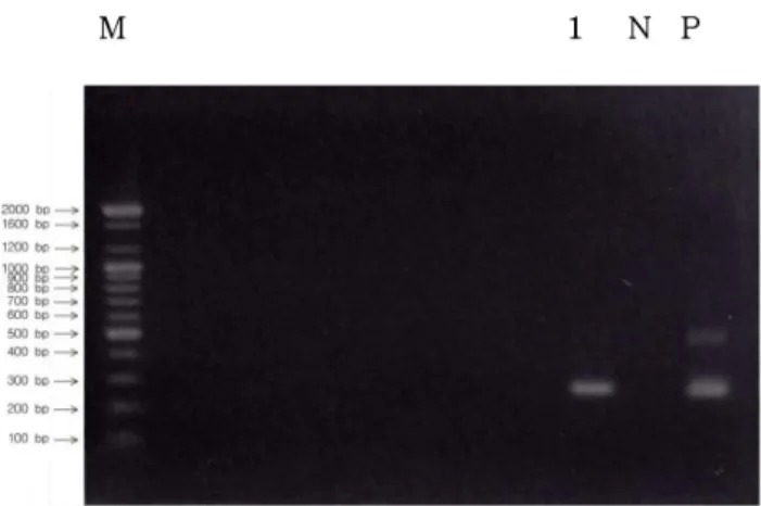 Fig.  1.  Detection  of  Mycobacterium  tuberculousis   from  acid  fast  bacillus  smear-positive  sputum  specimens  by  two-tube  nested  PCR