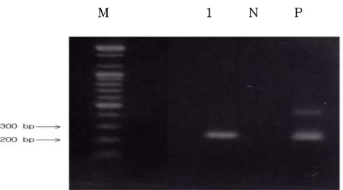 Fig.  3.  Detection  of  Mycobacterium  tuberculousis   from  cultured  colony  of  acid-fast  bacillus  smear-positive  specimens  by  two-tube nested  PCR