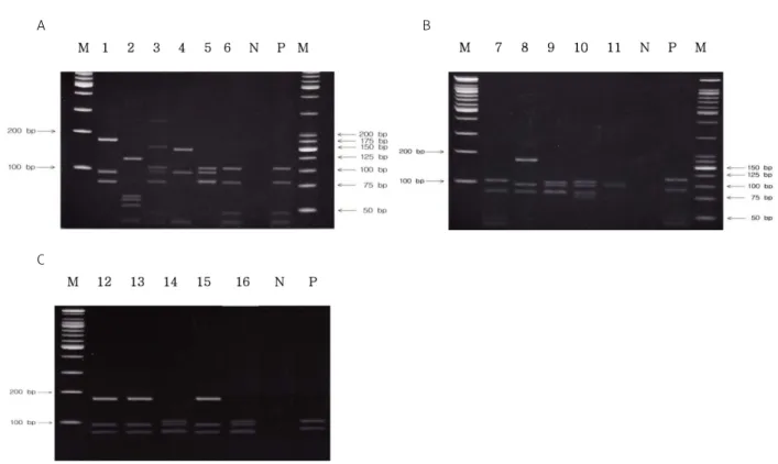 Fig.  5.  (A)  PCR  RFLP  analysis  using  cultured  colony  of  acid-fast  bacillus  smear-positive  specimens