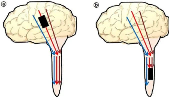 Fig.  8.  Illustration  of  electrical  stimulation  motor  evoked  potential  pathway  from  the  brain  tumor  ⓐ  and  spinal  cord  tumor  ⓑ.