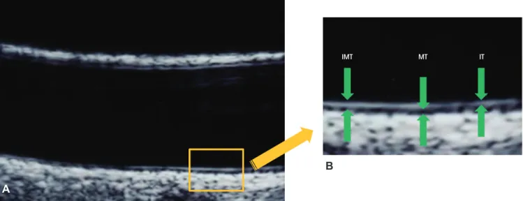 Fig. 2. Comparison of HEIT and IT. (A-C) Normotensive rats. (D-F) Spontaneously hypertensive rats SHR