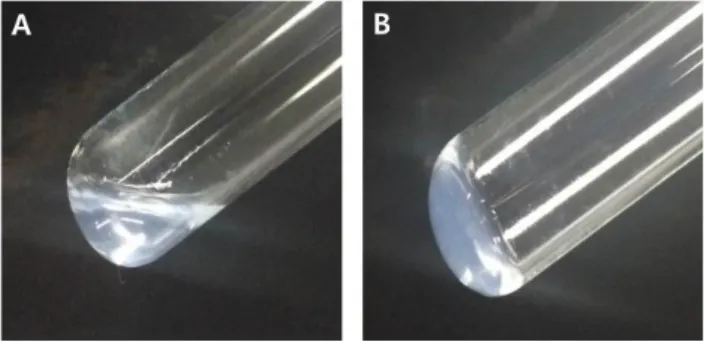 Fig.  1.  Determination  of  the  gel  clot  endotoxin  test.  (A)  Negative  and  (B)  positive.