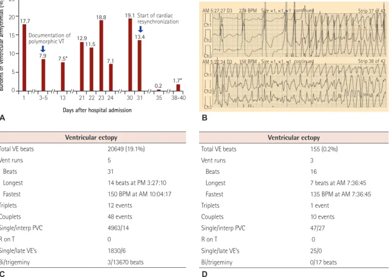 Fig. 3. Ventricular arrhythmia burden before and after initiation of cardiac resynchronization therapy