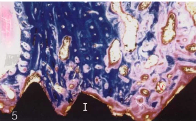 Fig. 6. Smooth machined implant at 8 weeks. New bone  formation can be seen in intimate contact with the threads