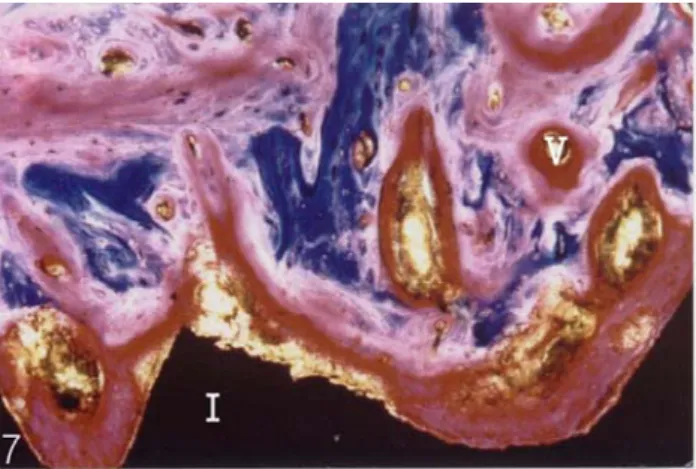 Fig. 8. At 12 weeks implantation. There is mature bone around  the implant surface. It is possible to observe new compact bone with few spaces, the newly formed bone tissue are separated  by slightly  gap from the implant