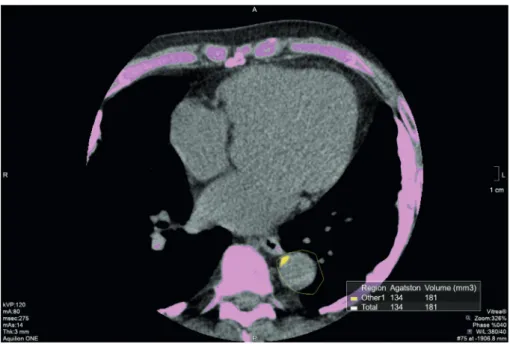 Figure 1. TACS. 