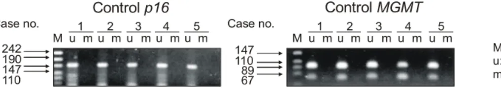 Fig.  1.  Methylation-specific  PCR  of  p16  and  MGMT  promoter  in  normal  liver  tissues